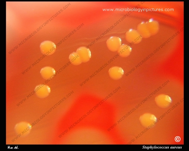 s.aureus staphyloxanthin